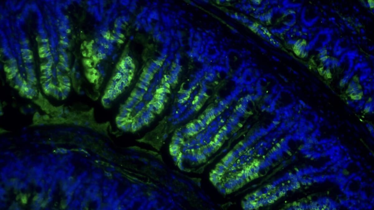 New Pill Mimics Exercise to Preserve Muscle During Weight Loss