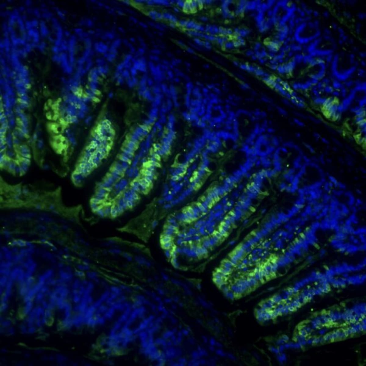 New Pill Mimics Exercise to Preserve Muscle During Weight Loss - Image 2