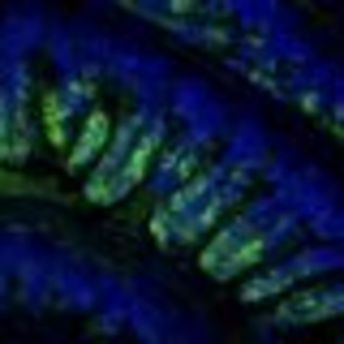 First Drug for Post-Surgery Blood Sugar Drops Succeeds - Image 3
