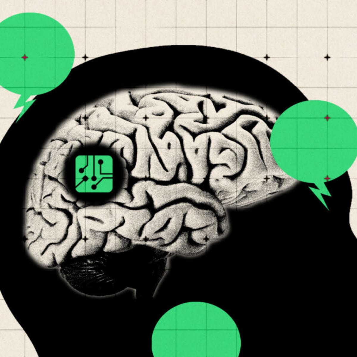 Patients Weigh In on Brain Implant "Minimally Invasive" Claims - Image 2