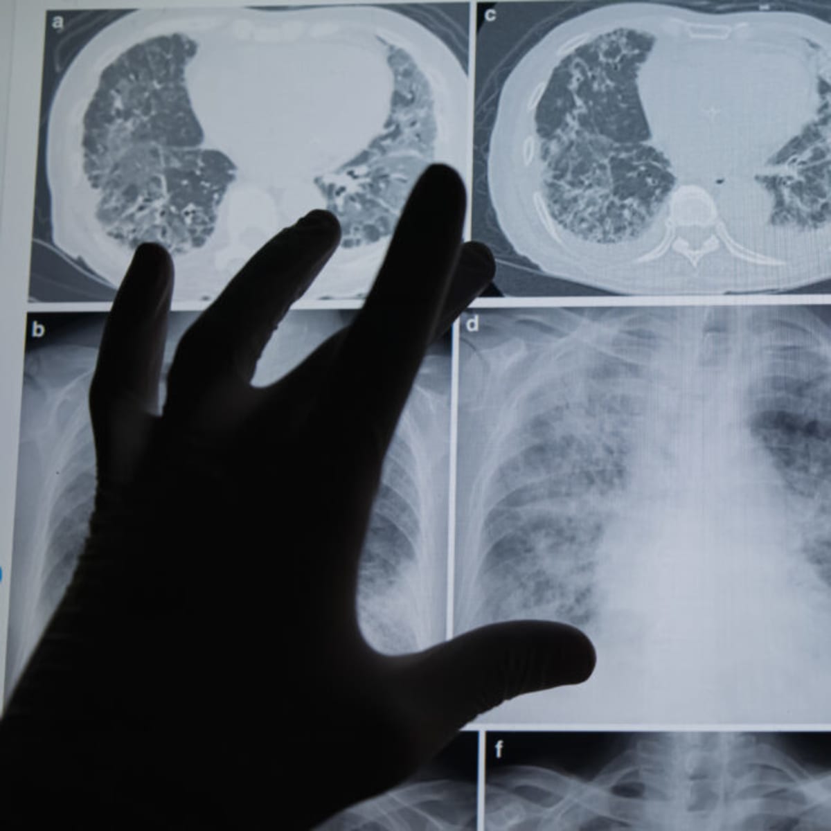 Professor Uses His Own Cancer to Train Future Doctors - Image 2