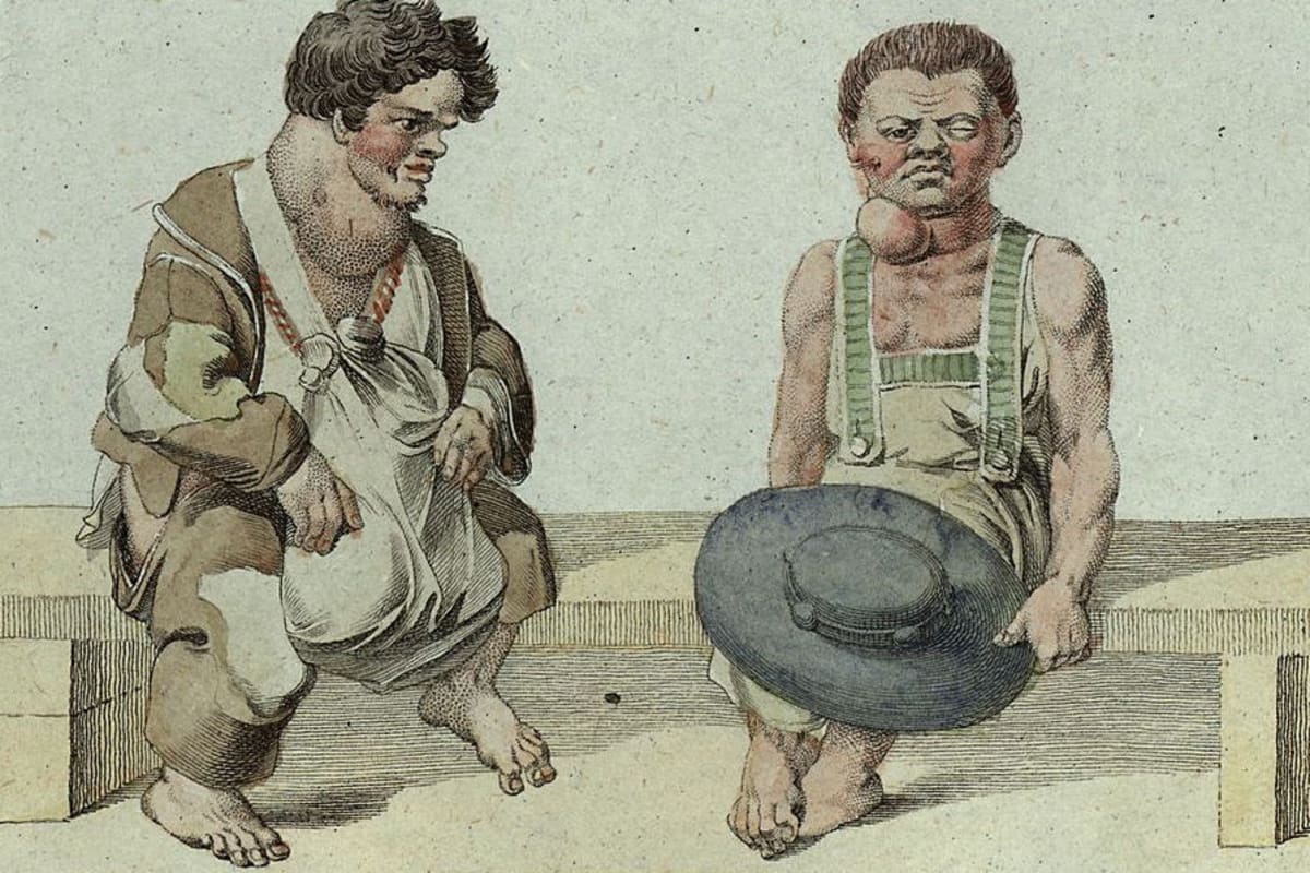 ** Historic illustration showing the devastating effects of cretinism in Alpine communities before iodized salt intervention