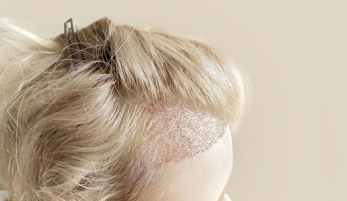 Scientists Solve Mystery of How Hair Patterns Form Naturally - Image 2