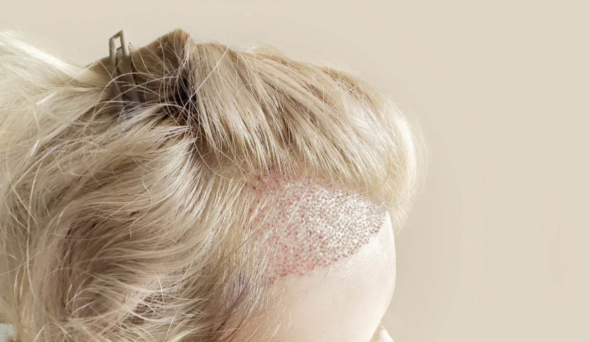 Scientists Solve Mystery of How Hair Patterns Form Naturally - Image 3