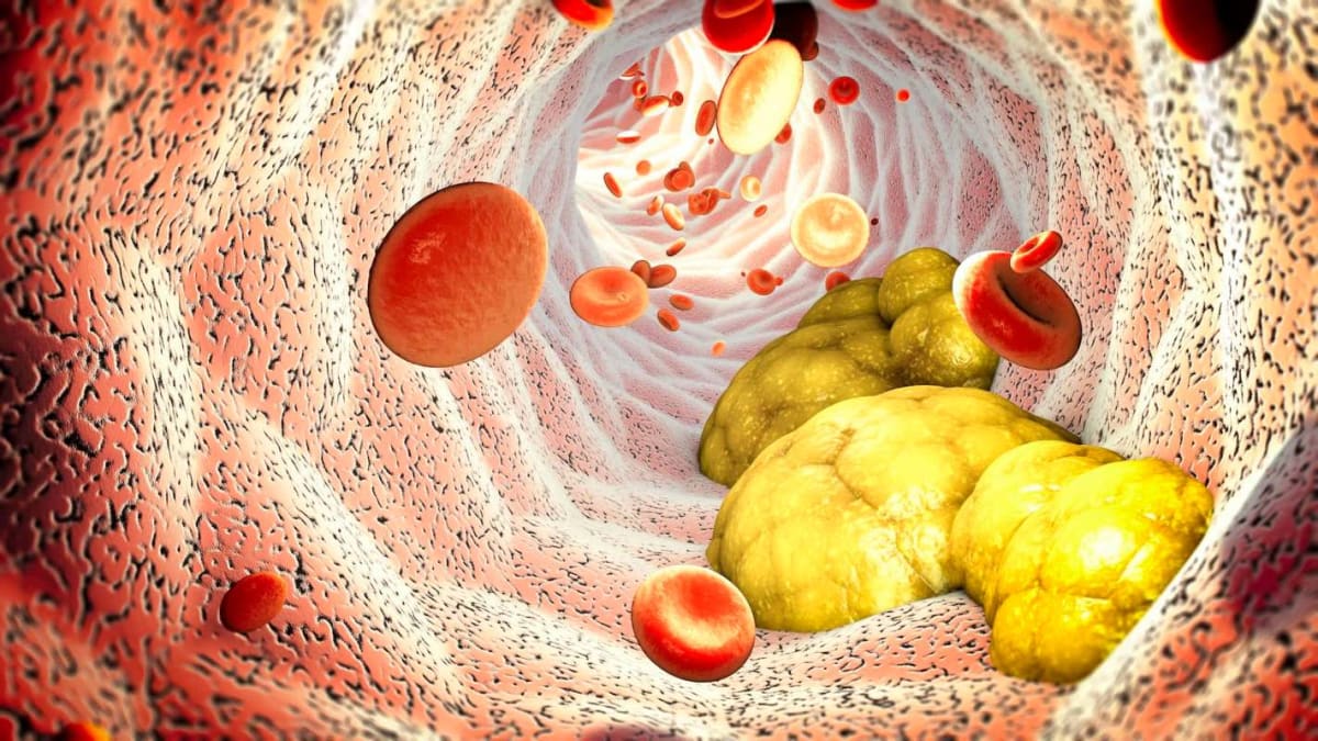 Cholesterol Treatment Cuts Forever Chemicals by Up to 76% - Image 2