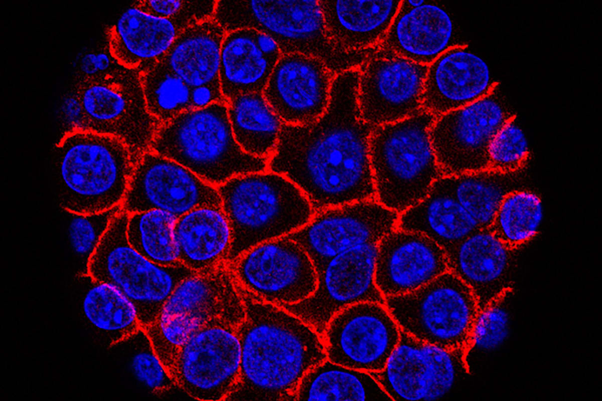 Experimental Pill Extends Lives in Pancreatic Cancer Trial - Image 5