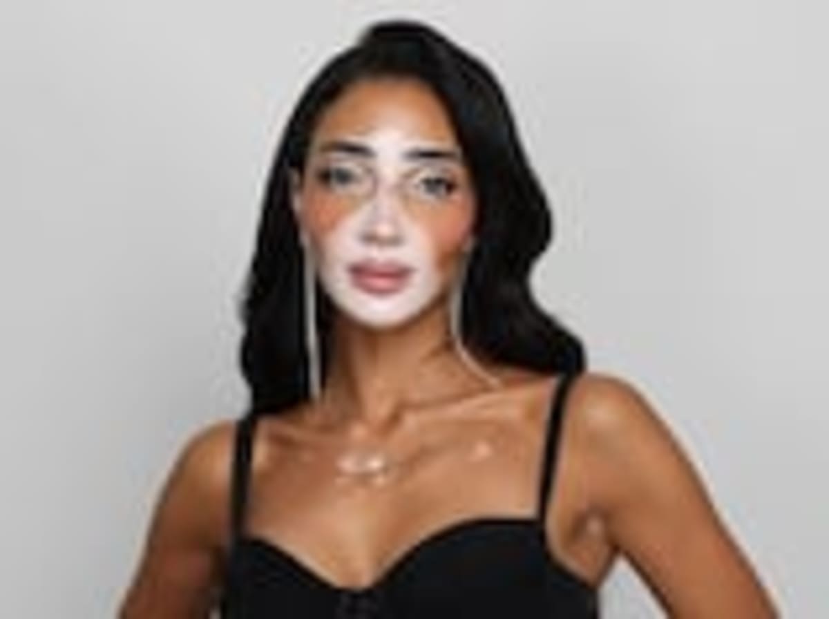 UAE Approves World's First Vitiligo Treatment Drug - Image 2