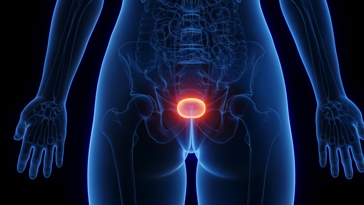 Bladder Cancer Drug Could Spare Thousands From Surgery