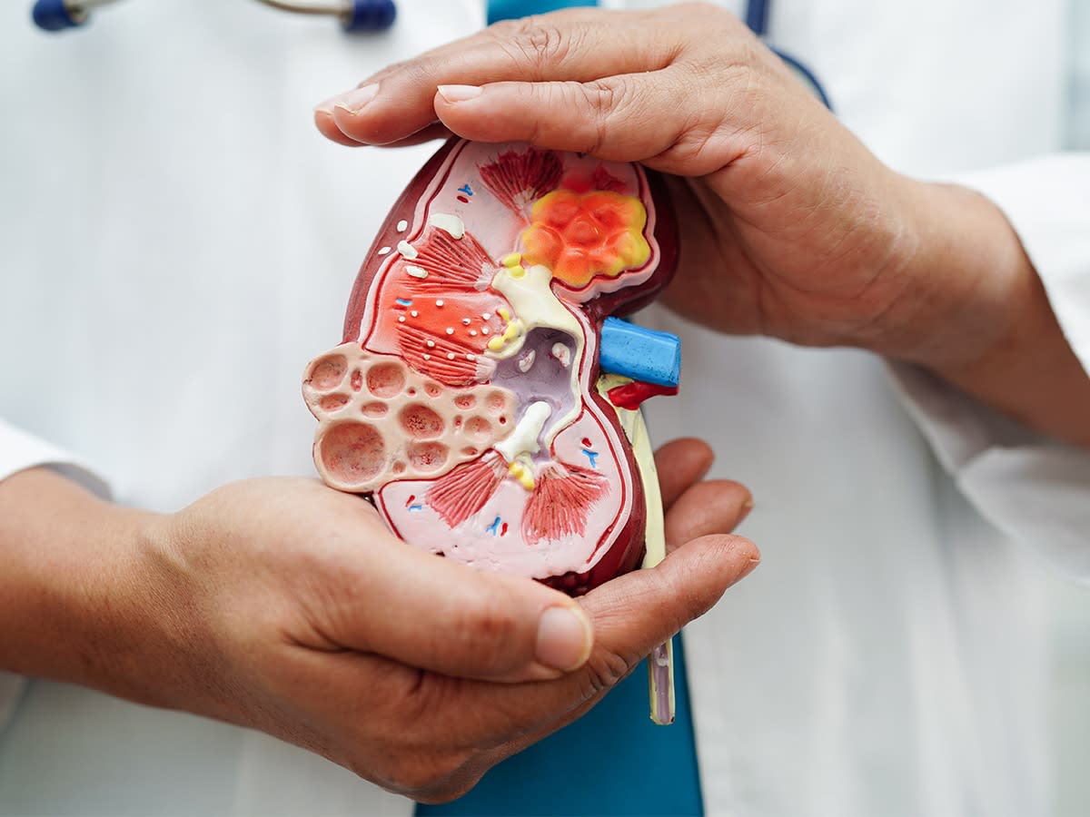 Alabama Researchers Unlock 3 New Treatments for Rare Kidney Disease