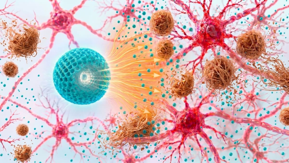 Microscopic nanoparticles illustrated against neural network background showing Alzheimer's research breakthrough
