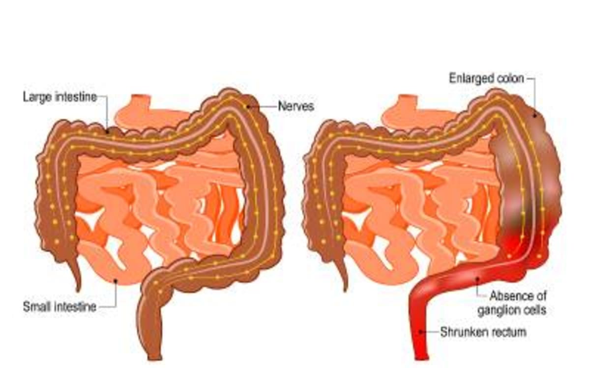 UK Scientists Develop 6-Day Stem Cell Cure for Rare Gut Disease