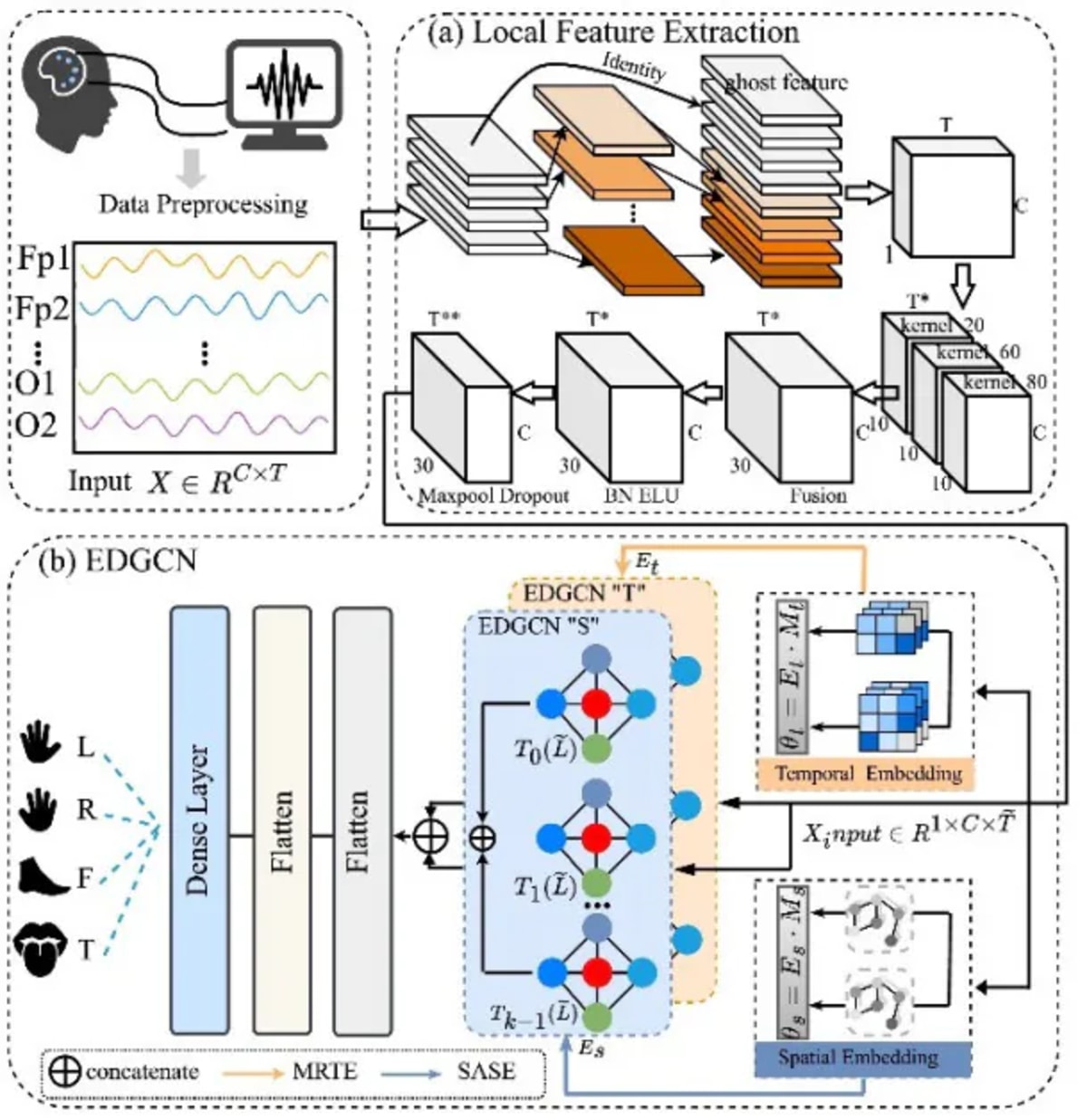 Japan AI Decodes Thoughts at 90% Accuracy for Paralysis Aid - Image 3
