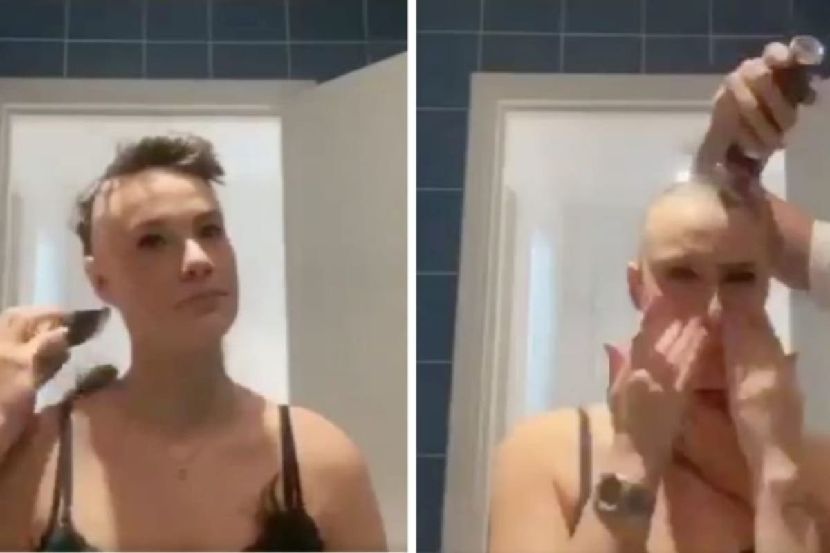 Boyfriend Shaves Head in Solidarity with Alopecia Girlfriend - Image 4