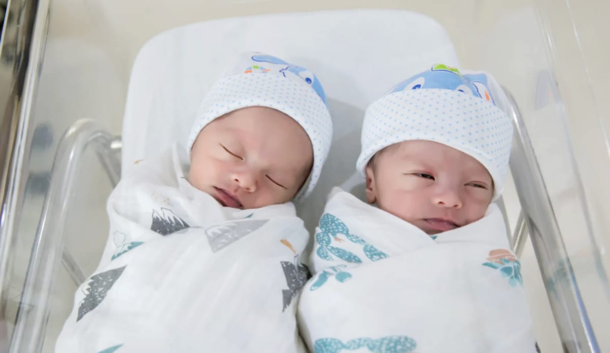 Smaller Twin Doctors Wanted Aborted Saves Sister's Life - Image 3