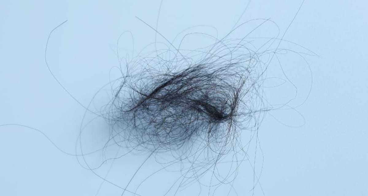 Salons Turn Hair Clippings Into Deer-Proof Tree Guards - Image 5