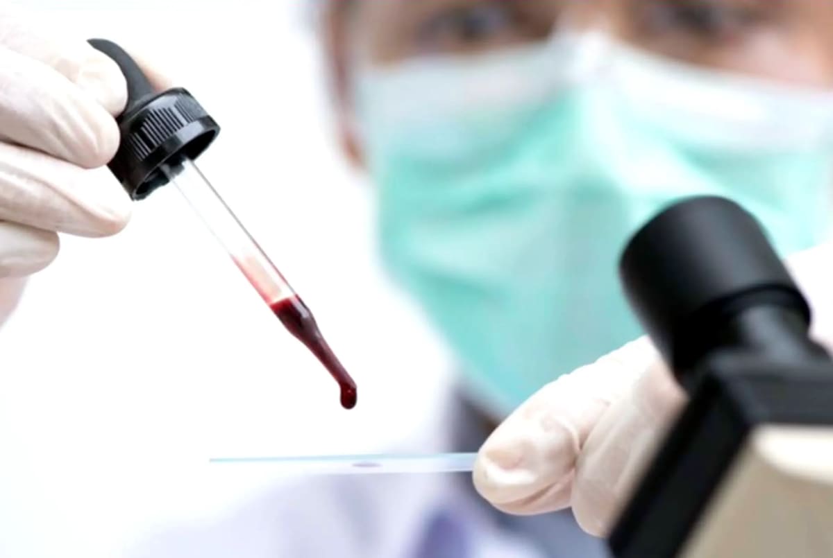 Blood Cell Study Reveals Humans Differ from Mice Models