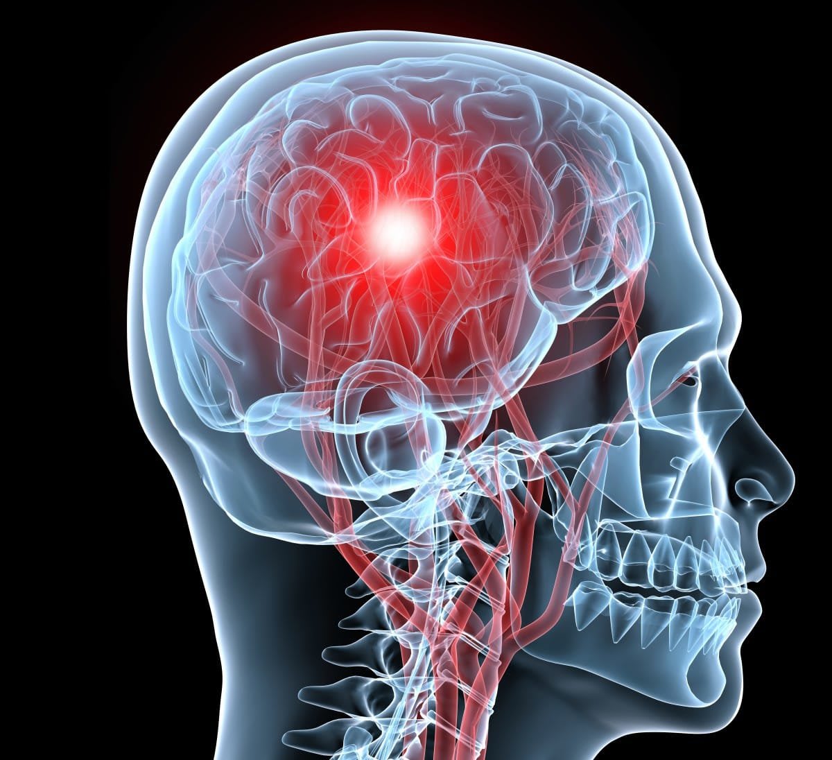 ** Medical researcher examining brain scan images showing glymphatic system fluid movement patterns