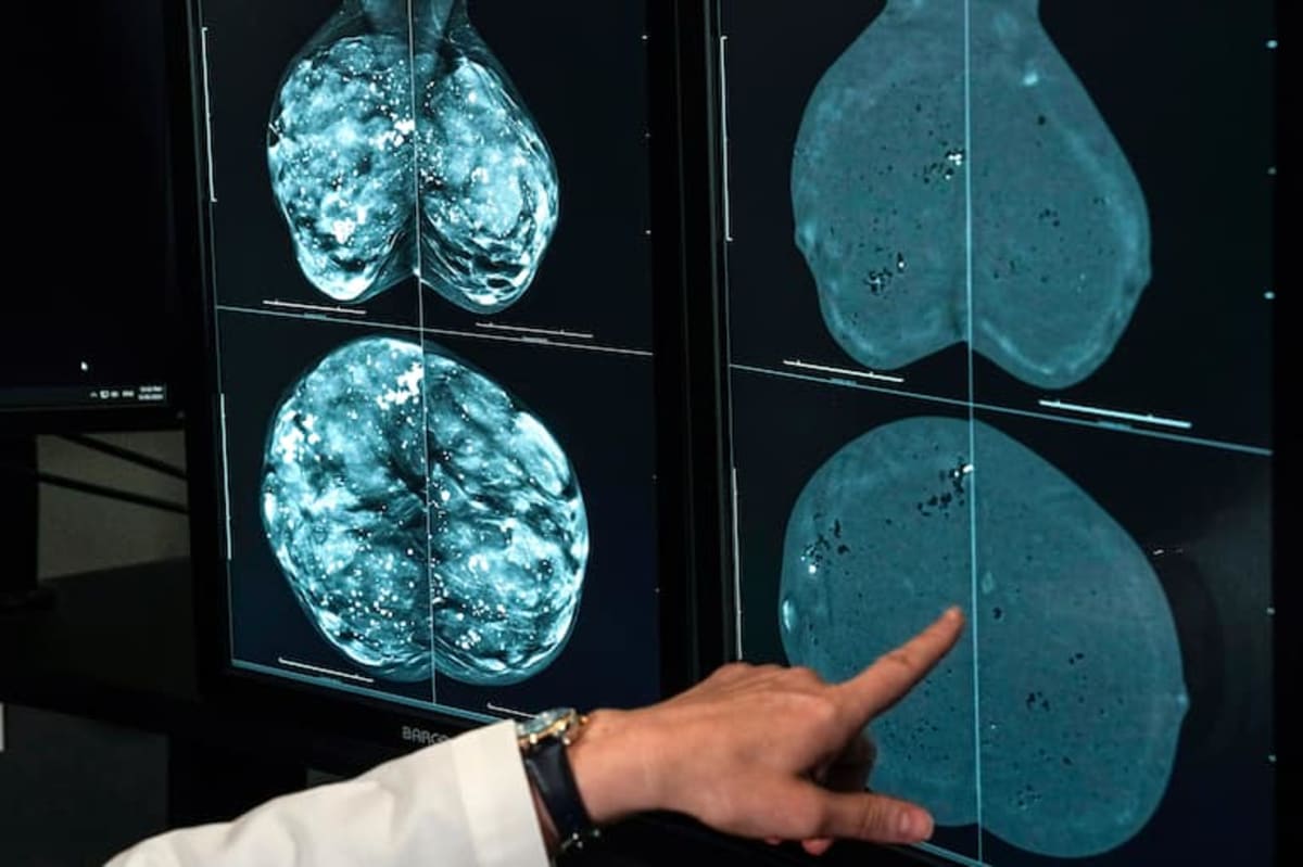 Oncologist: Exercise Cuts Cancer Risk, Not Just Heart Disease - Image 2