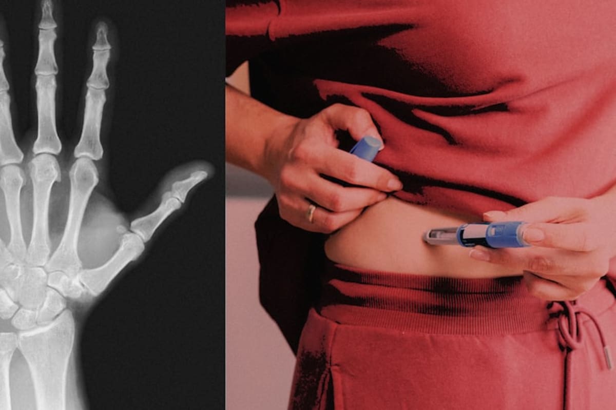 Mammograms Now Detect Heart Disease Risk in Women - Image 4