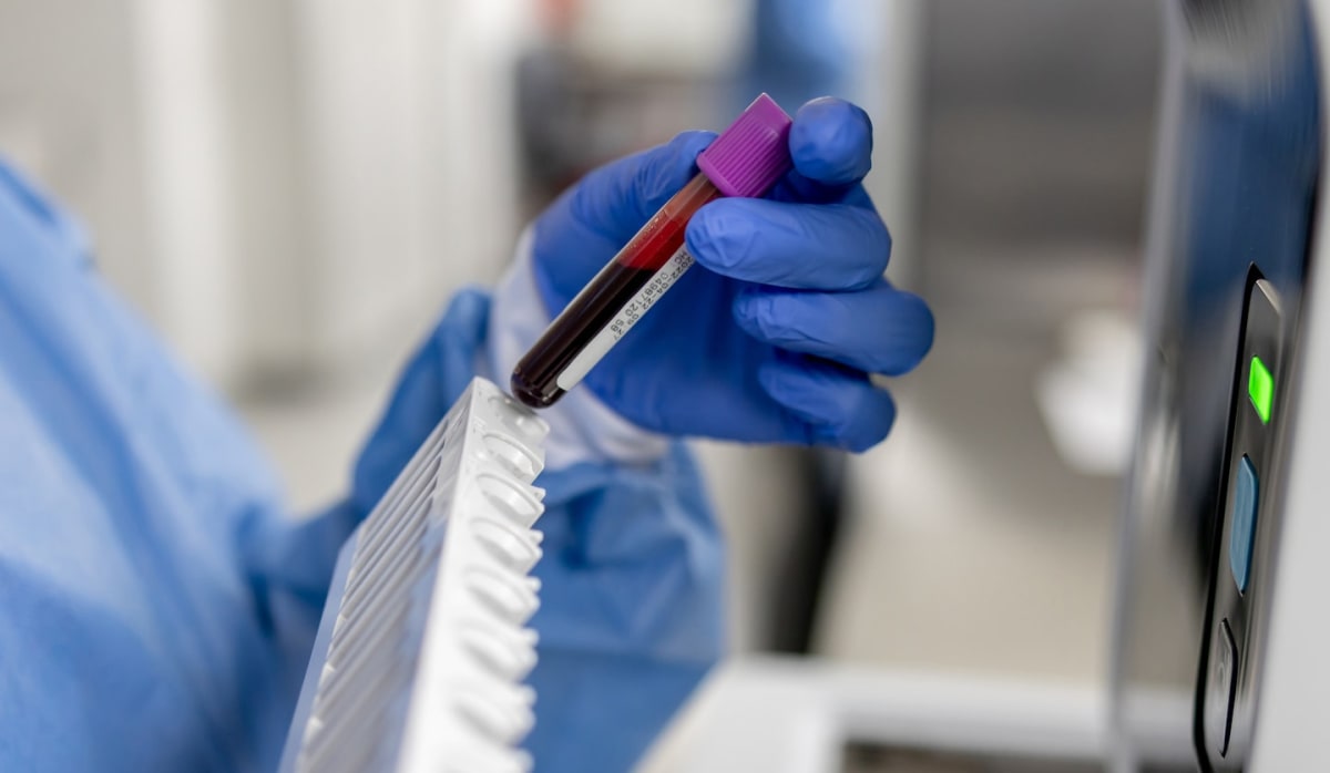 Doctor consulting with male patient about prostate cancer screening and prevention options