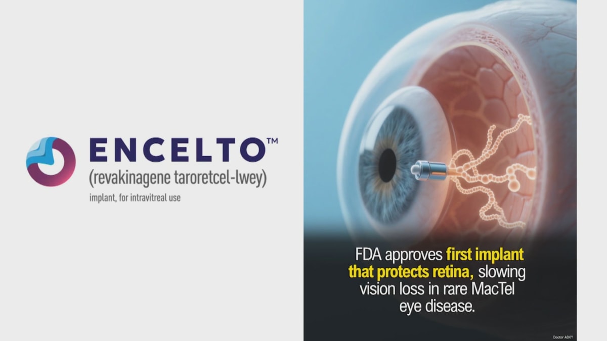 FDA Approves Vision-Saving Implant for Rare Eye Disease