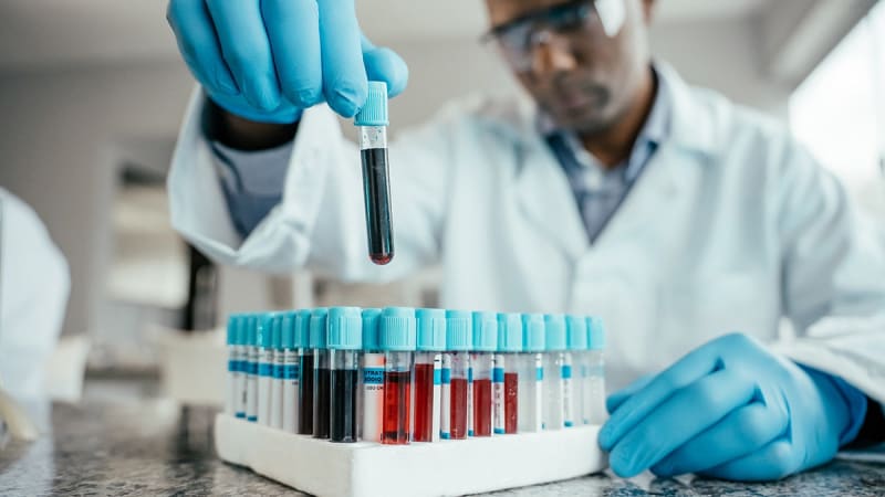 Blood Test Could Detect Parkinson's 20 Years Early - Image 5