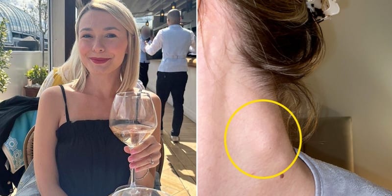 Mom's Wine Pain Leads to Early Cancer Catch - Image 2