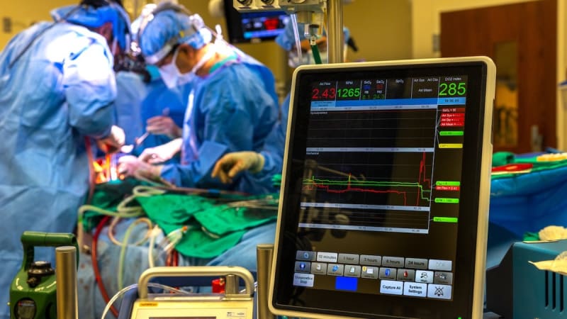 Surgeons Keep Man Alive 48 Hours Without Lungs - Image 4