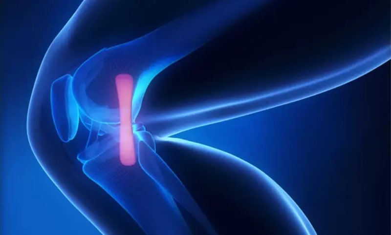 Egypt Speeds Up Joint Replacements to End Waitlists - Image 2