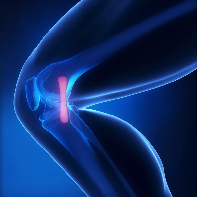 Egypt Speeds Up Joint Replacements to End Waitlists