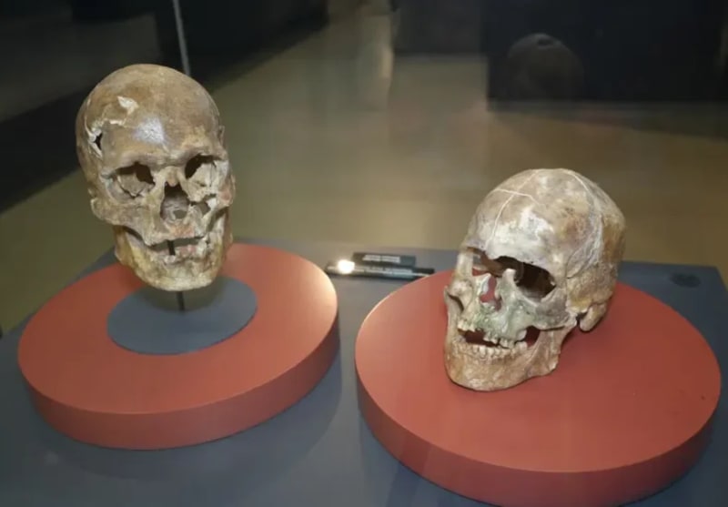 5,000-Year-Old Skull Shows Ancient Brain Surgery Worked