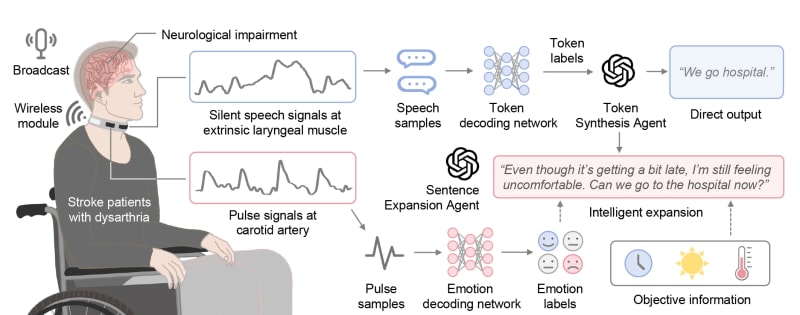 Cambridge Creates Voice Device for Stroke Survivors - Image 4