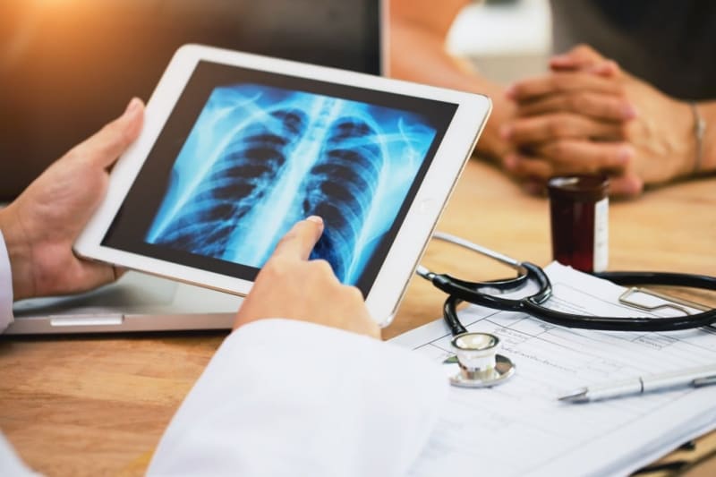 Morning Lung Cancer Treatment Nearly Doubles Survival Time - Image 2
