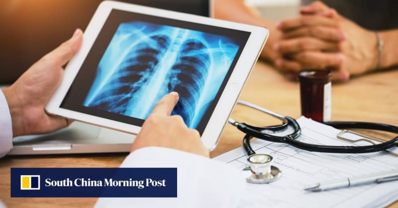 Morning Lung Cancer Treatment Nearly Doubles Survival Time