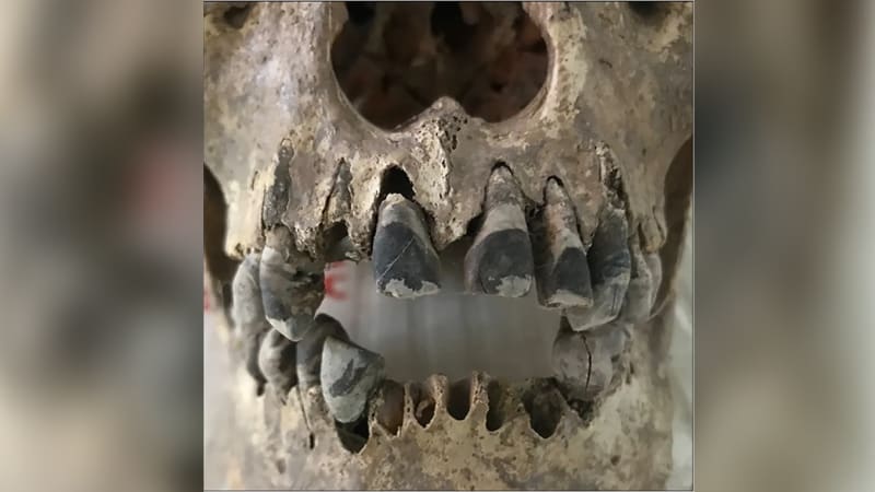 2,000-Year-Old Teeth Reveal Ancient Vietnamese Beauty Trend - Image 2