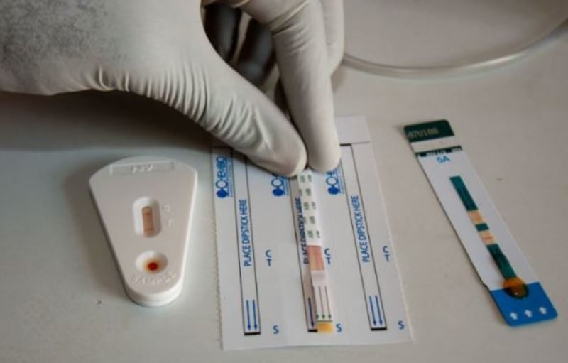 Nigeria Becomes First in Africa to Package WHO HIV Tests