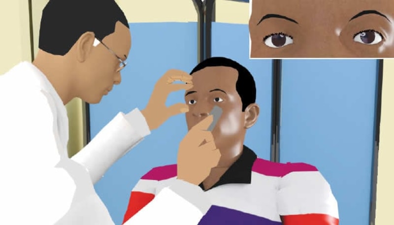 Nigeria Invests $15M to Restore Sight for Millions