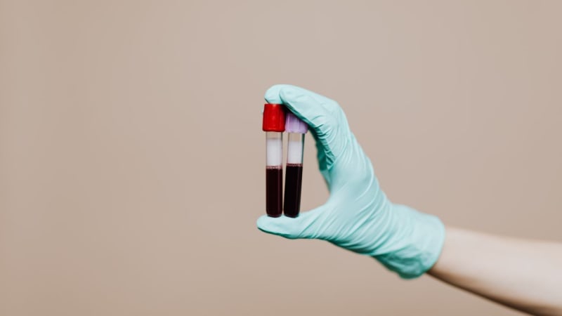 New Blood Test Monitors Myeloma Without Invasive Procedures