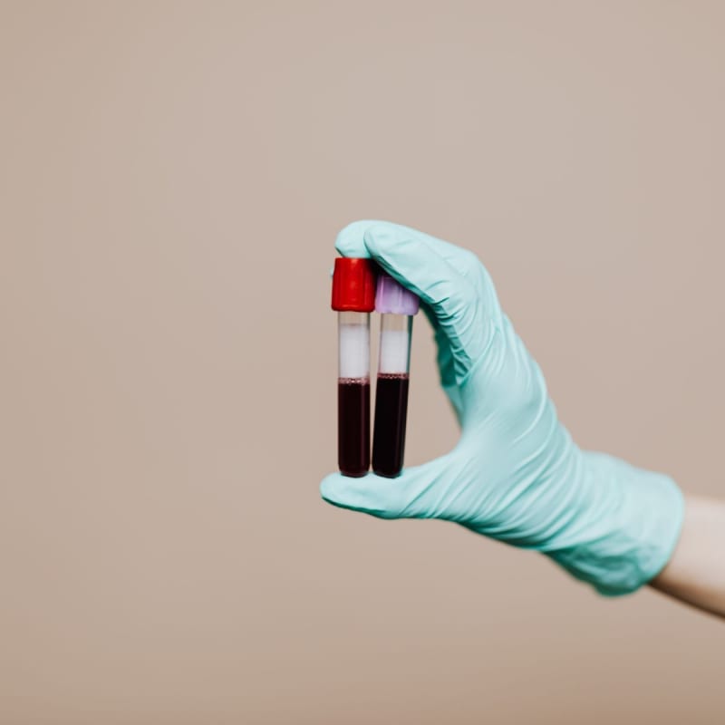 New Blood Test Monitors Myeloma Without Invasive Procedures - Image 2