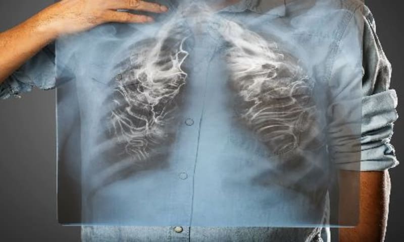 New Legal Path Curbs Big Tech's Data Collection - Image 2