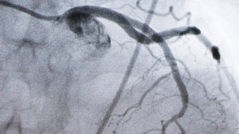 New Cholesterol Pill Shows Promise for Millions - Image 2