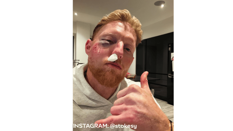 Ben Stokes Recovers After Successful Eye Surgery - Image 3