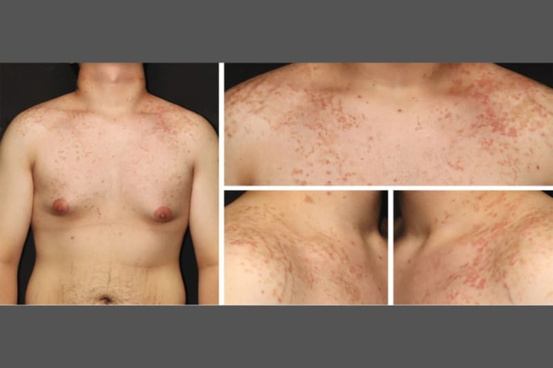 Oregon Dog Gets Rare Brain Surgery, Now Back to Daily Walks - Image 4