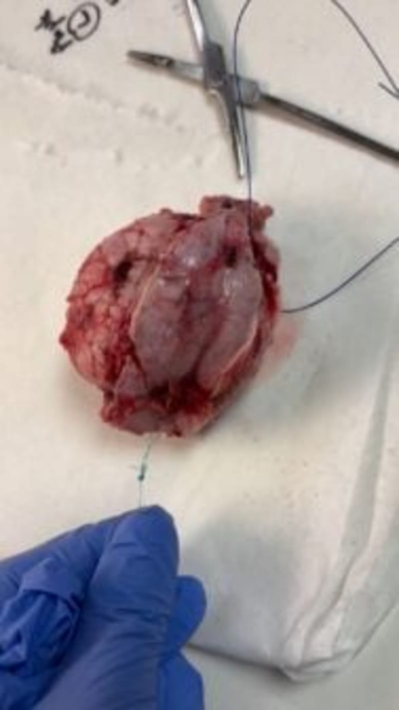 Oregon Dog Gets Rare Brain Surgery, Now Back to Daily Walks - Image 3