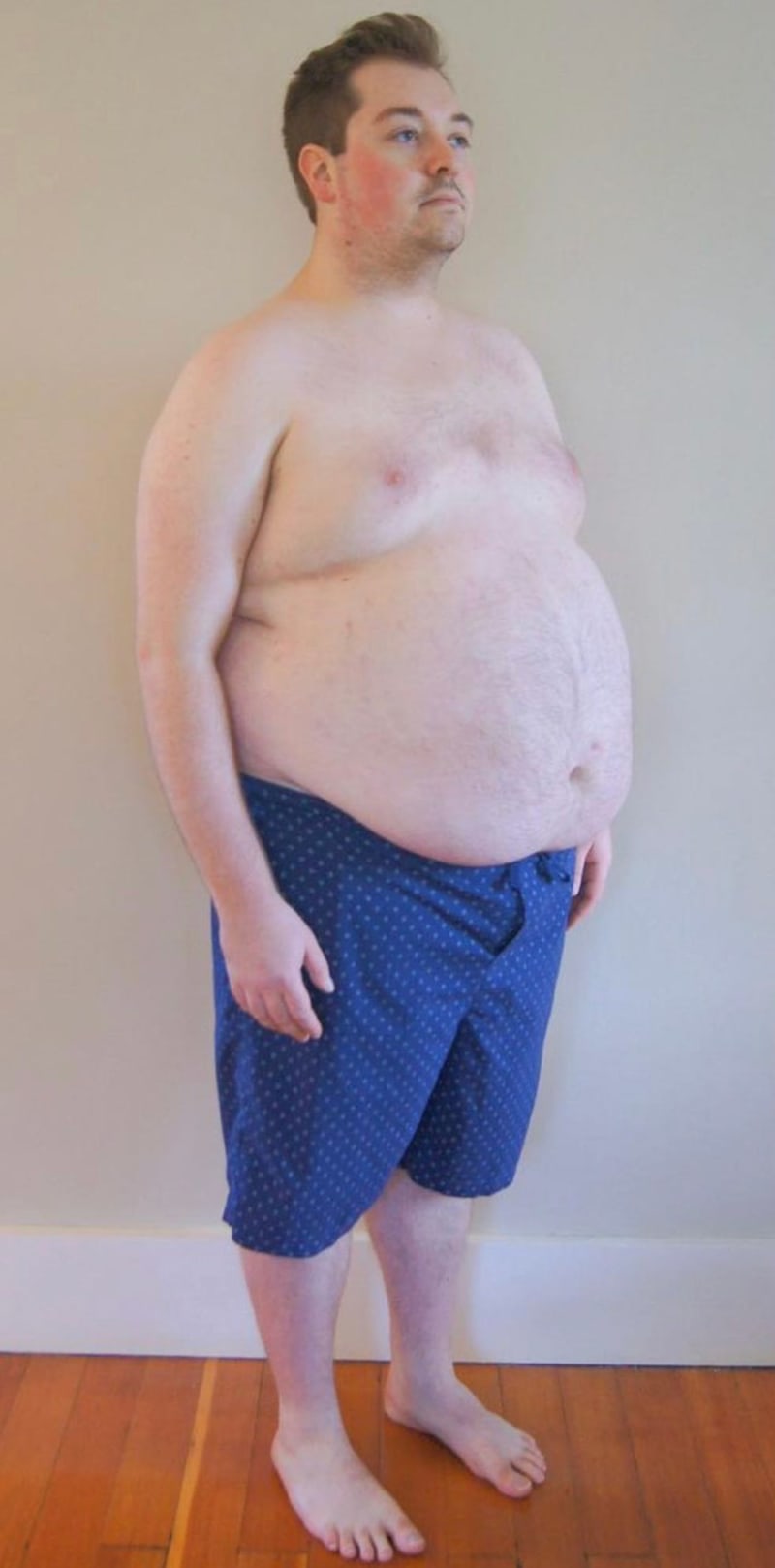 Doctor Loses 125 Pounds After Sister's Cancer Diagnosis - Image 4