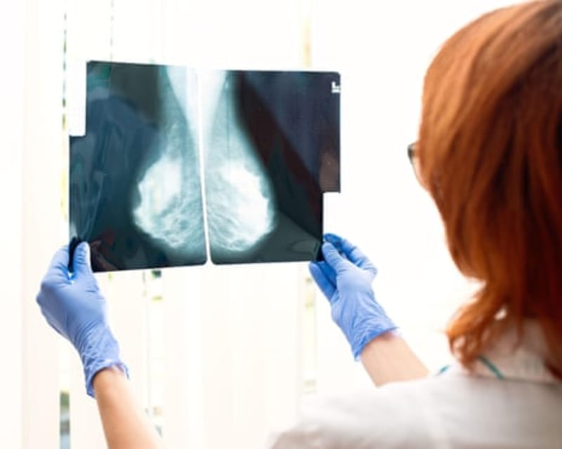 Blood Test Predicts Best Breast Cancer Treatment in 4 Weeks - Image 3