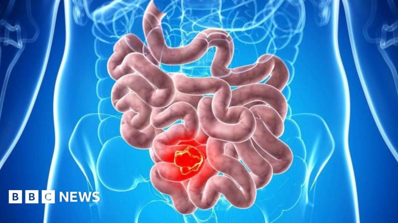 Glasgow Scientists Find New Way to Stop Deadly Cancers