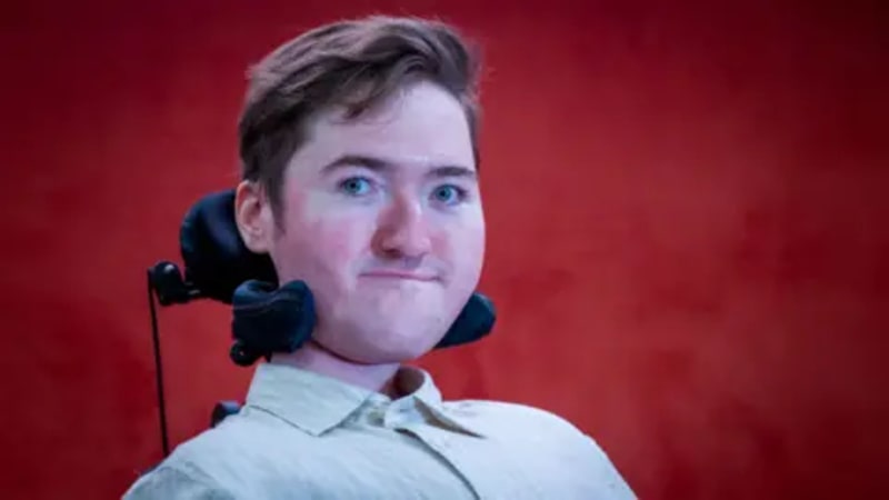 BBC Journalist Thrives at 25 After Doctors Said He'd Die at 2 - Image 4