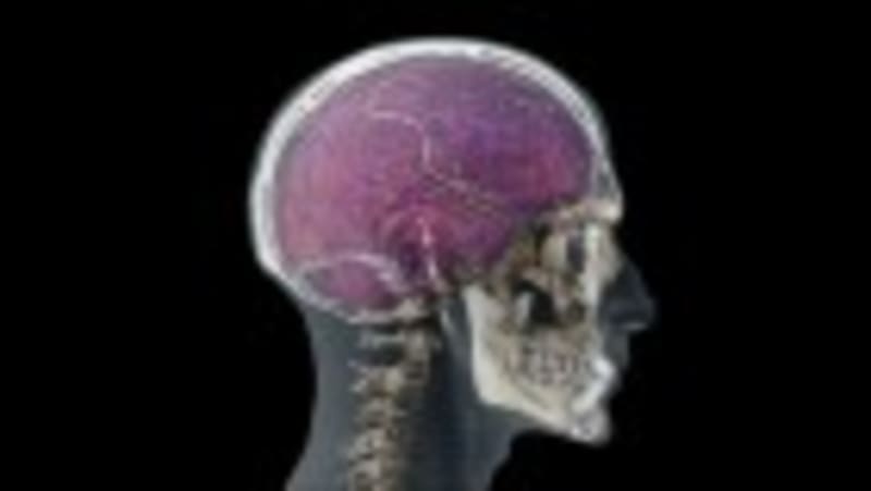 Blood Test May Predict When Alzheimer's Symptoms Will Start - Image 3