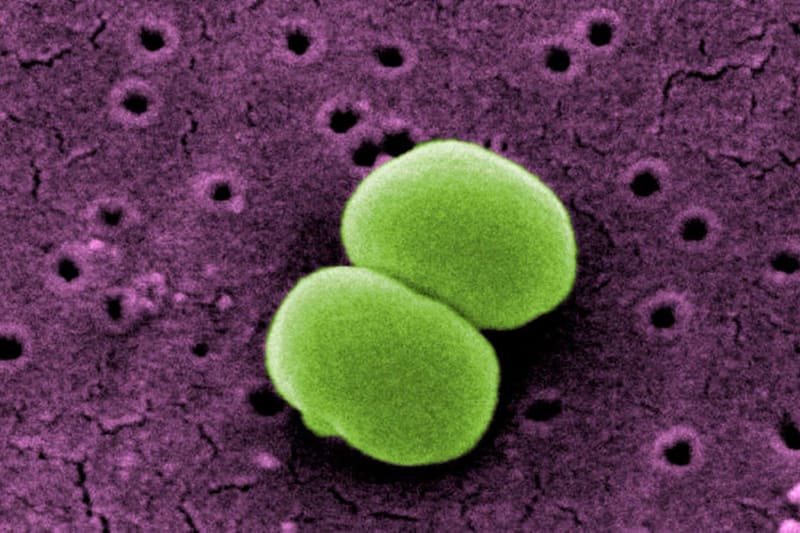 Placenta Dressings Cut Scarring in New Wound Study - Image 5